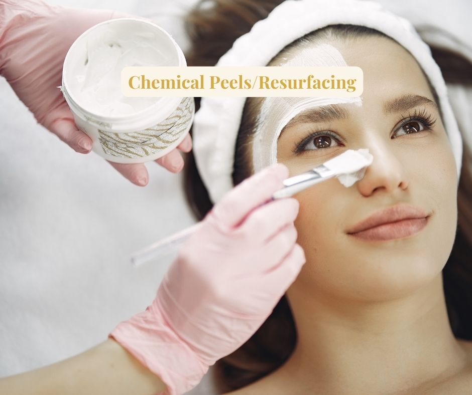 Chemical PeelsResurfacing