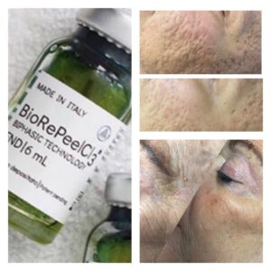 biorepeel