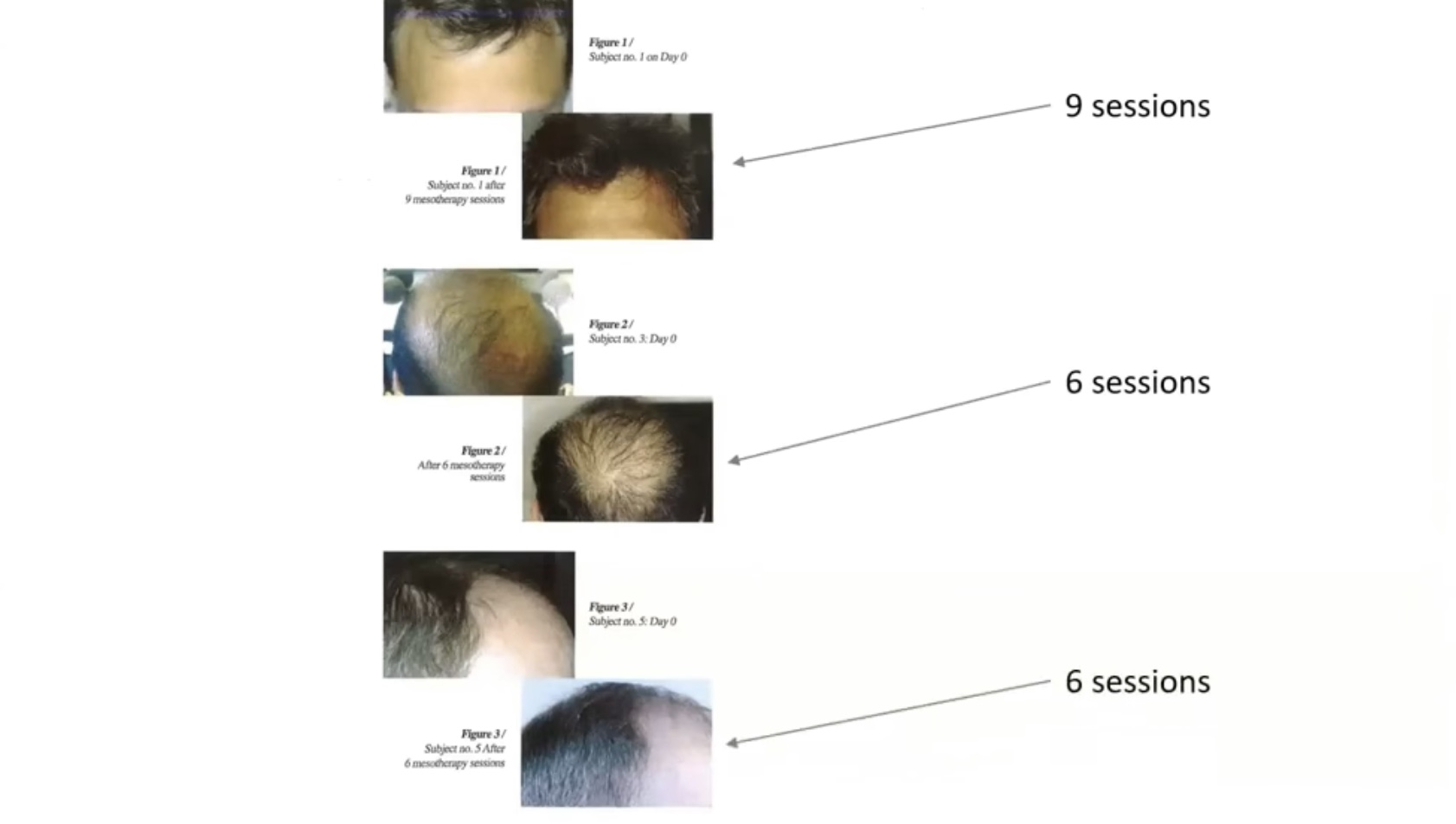 hair photo before & after hair before & after