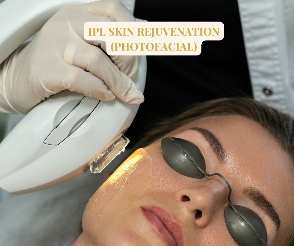 IPL Skin rejuvenation 