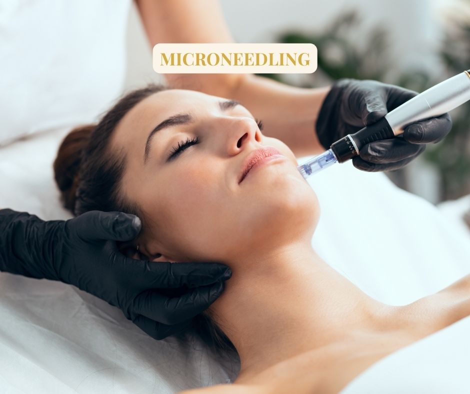 MICRONEEDLING microneedling
