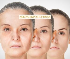 Ageing skin solutions